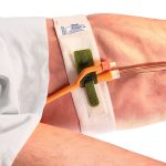 Hold-N-Place Foley Catheter Holder 316 Dale Medical Latex-Free-0